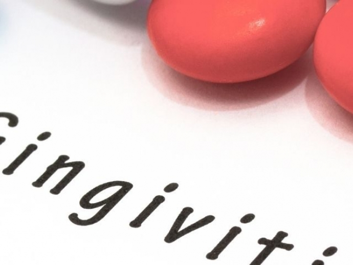 The Complete Guide to Gingivitis and How to Treat It: Find Trusted Dentists on DentistList